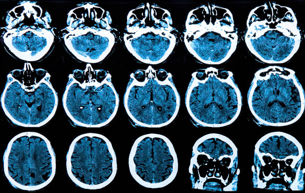 resonancia magnética del cerebro humano - phase image mri scan science nobody fotografías e imágenes de stock