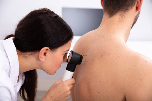 istock Doctor Examining Pigmented Skin On Man's Back 1075626134