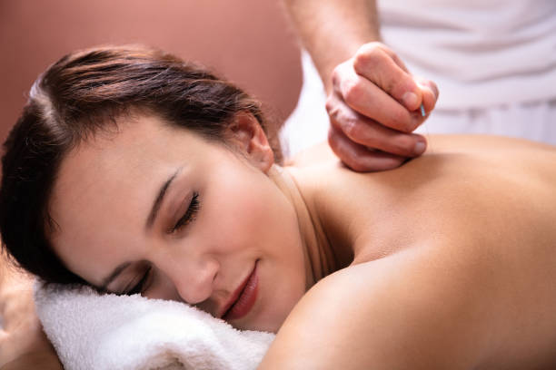 istock Woman Going Through Acupuncture Treatment 1075627756