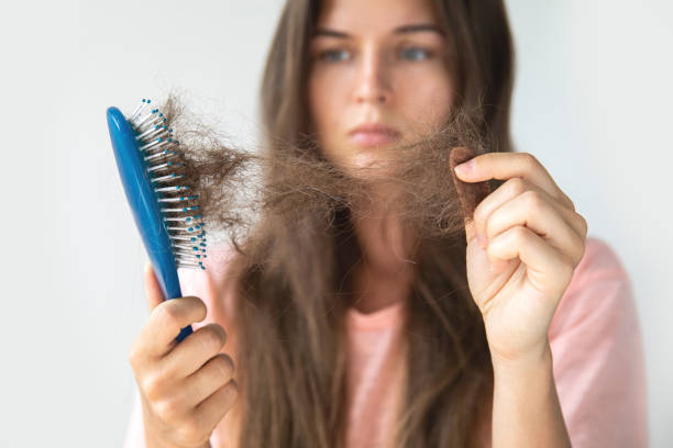 Young woman is upset because of hair loss stock photo