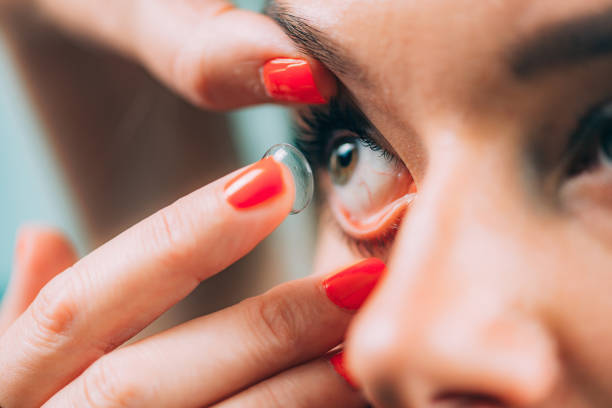 istock Ophthalmology. Soft contact lens insertion. 1076078632