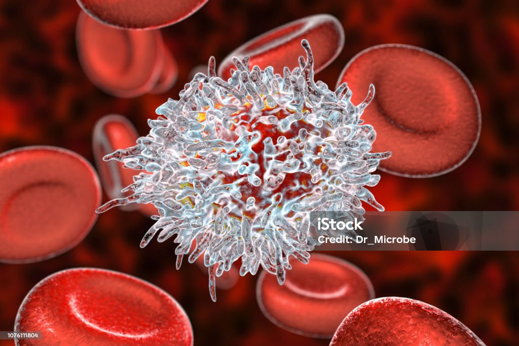 Hairy cell leukemia Hairy cell leukemia, 3D illustration. It is a hematological malignancy, chronic lymphocytic leukemia, with accumulation of abnormal B lymphocytes Leukemia Stock Photo