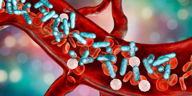 Sepsis, bacteria in blood stock photo
