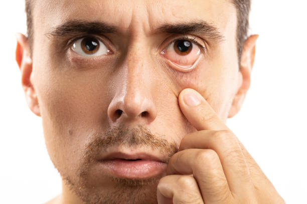 istock Man checking condition of his eye 1076274760