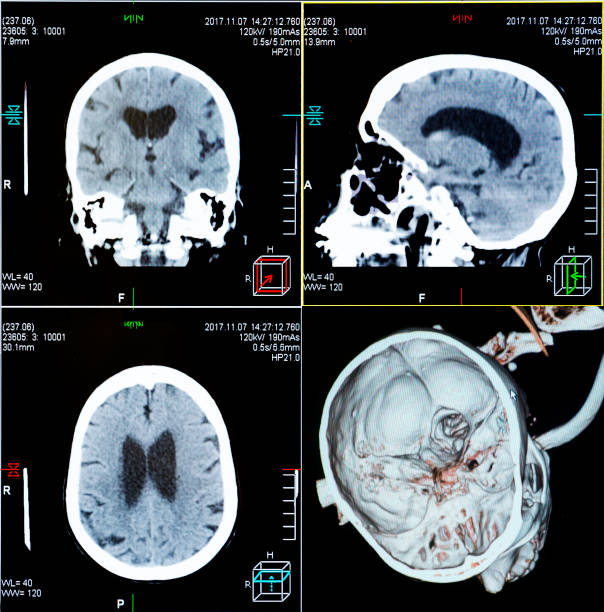 istock CT scans of human head 1076801602