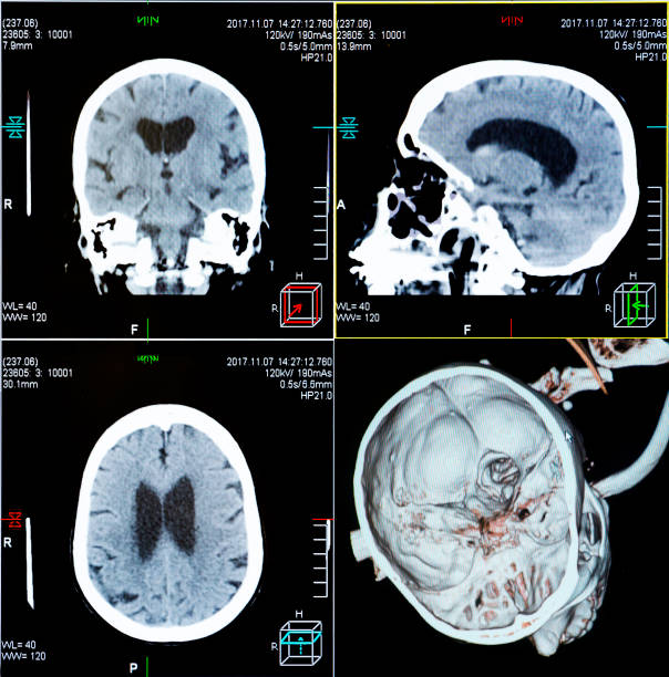 tomografia komputerowa ludzkiej głowy - mri scan cat scan machine x ray brain zdjęcia i obrazy z banku zdjęć