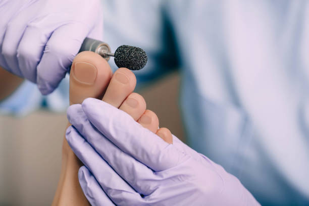 istock Chiropodist treating a patient's foot, pedicure treatment 1076840378