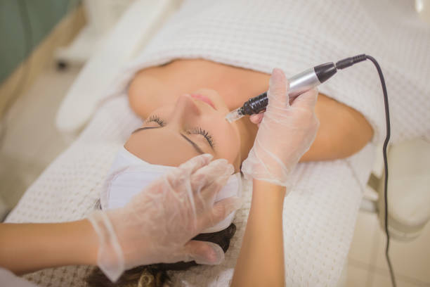 istock female face laser hair removal 1076842576