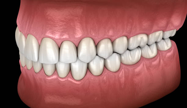 istock Healthy human teeth with normal occlusion, side view. Medically accurate tooth 3D illustration 1077065606