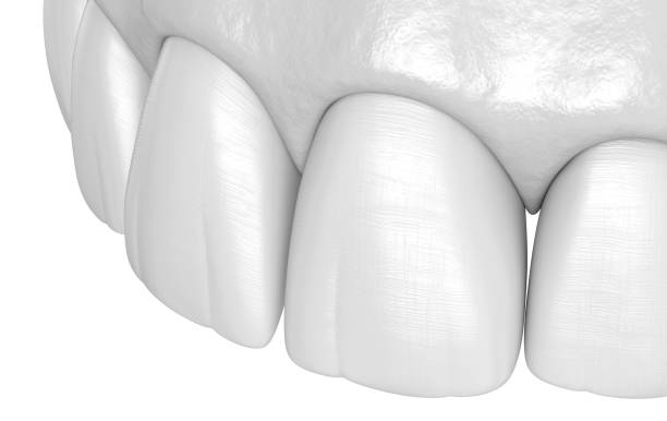 istock Maxillary human teeth - incisors. Medically accurate tooth 3D illustration 1077065624