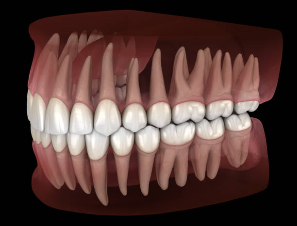 istock Morphology of mandibular and maxillary human gum and teeth. Medically accurate tooth 3D illustration 1077065680