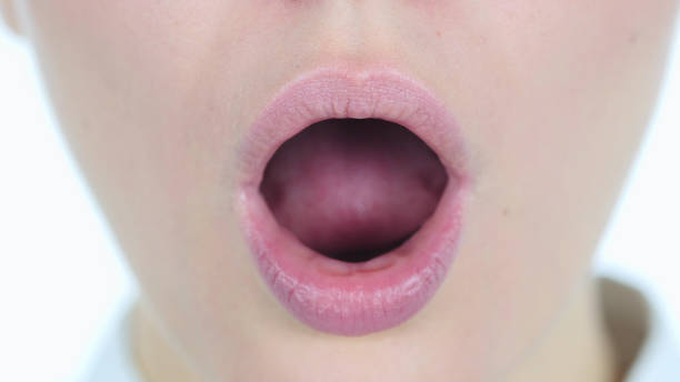 istock Close Up of Shocked, Surprised G White Background 1077311886