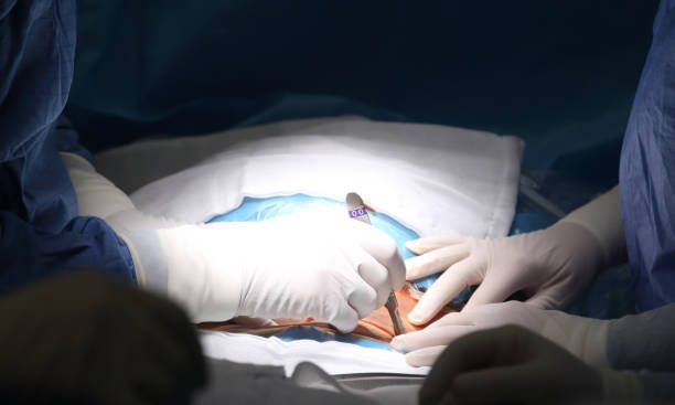 chirurgie de l’estomac - human hand science human muscle muscular build photos et images de collection