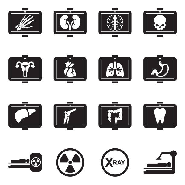 medyczne ikony rentgenowskie. czarny płaski design. ilustracja wektorowa. - x ray equipment x ray machine radiation stock illustrations