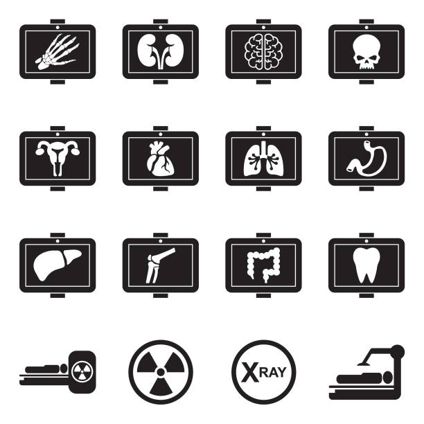 Medical X-Ray Icons. Black Flat Design. Vector Illustration. X-ray, Radiation, Hospital, RTG diagnostic equipment stock illustrations