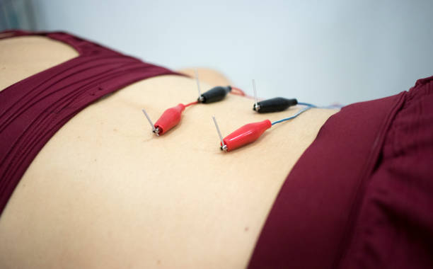 istock Physiotherapy clinic Intratissue Percutaneous Electrolysis EPI dry needling physiotherapist patient injury. 1079191034