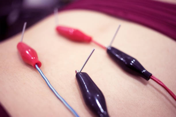 istock Physiotherapy clinic Intratissue Percutaneous Electrolysis EPI dry needling physiotherapist patient injury. 1079192160