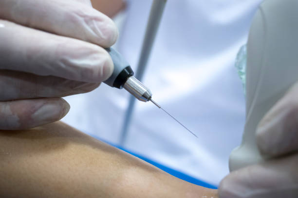 istock Physiotherapy clinic Intratissue Percutaneous Electrolysis EPI dry needling physiotherapist patient injury. 1079199998