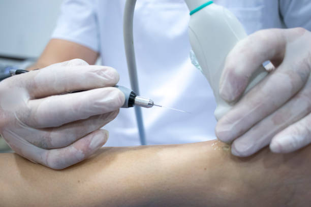 istock Physiotherapy clinic Intratissue Percutaneous Electrolysis EPI dry needling physiotherapist patient injury. 1079200108