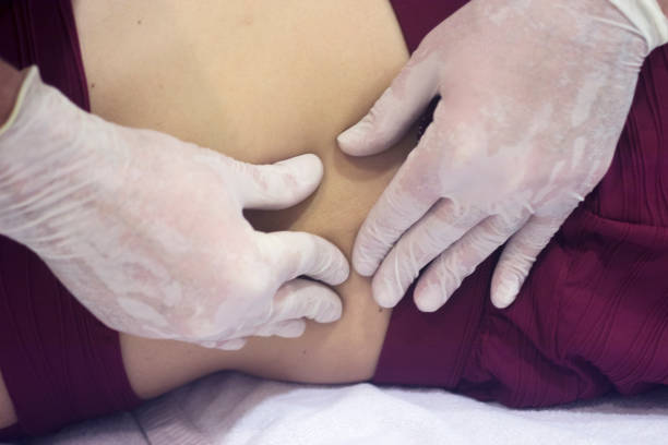 istock Physiotherapy clinic Intratissue Percutaneous Electrolysis EPI dry needling physiotherapist patient injury. 1079200168