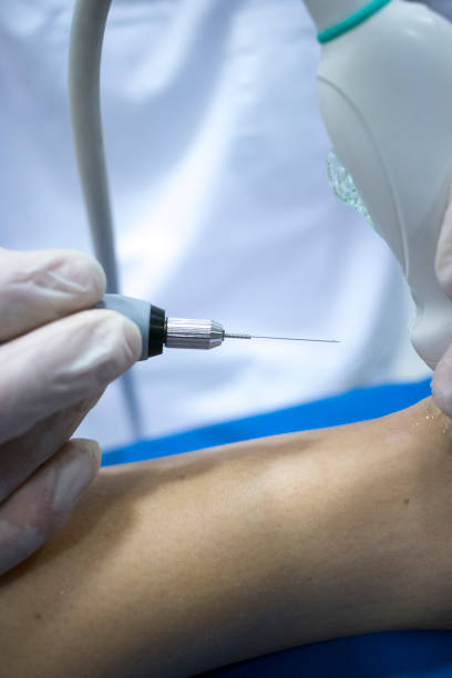 istock Physiotherapy clinic Intratissue Percutaneous Electrolysis EPI dry needling physiotherapist patient injury. 1079200198