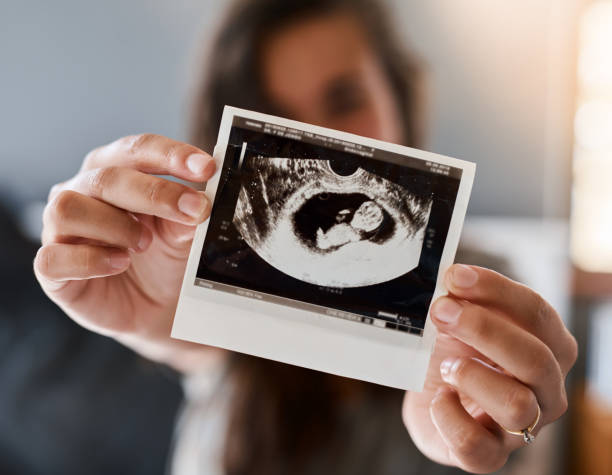 Baby's growing beautifully Shot of a woman holding a sonogram of her unborn baby ultrasound photos stock pictures, royalty-free photos & images