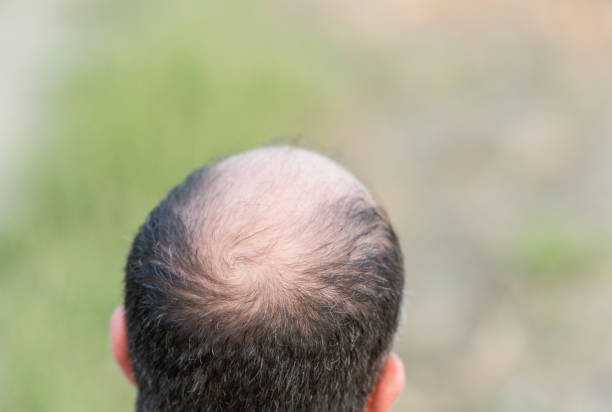 istock Soon to be outdoor portrait 1079906256
