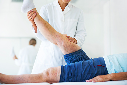 Closeup side view of  female doctor massaging legs and calves of a senior female patient with visible varicose veins on both legs. Both patient and doctor are recognizable.