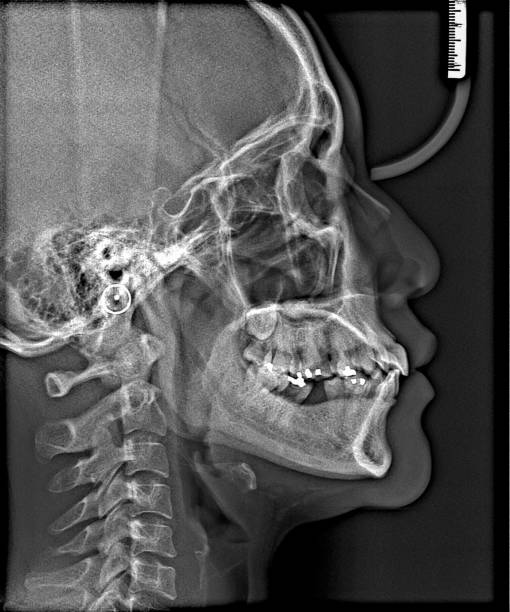 istock X-ray film Head and mouth 1080509906