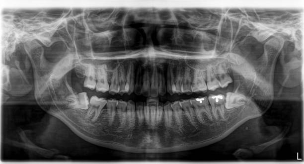 istock X-ray film Head and mouth 1080514770