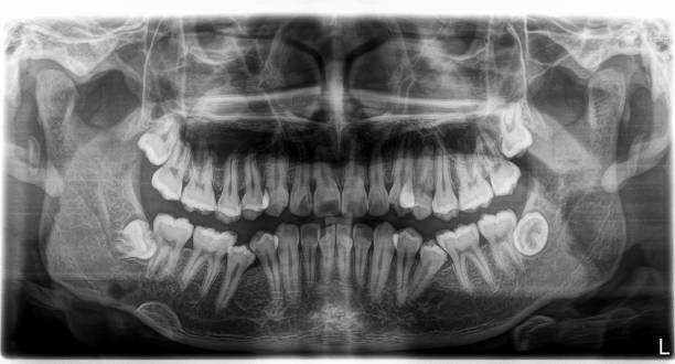 istock X-ray film Head and mouth 1080515296