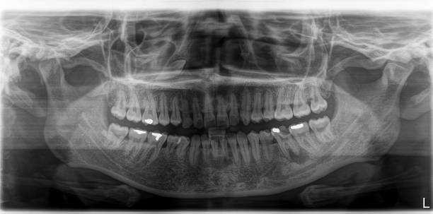 istock X-ray film Head and mouth 1080517944
