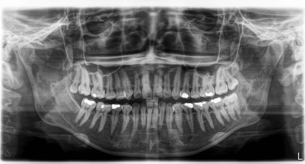 istock X-ray film Head and mouth 1080519066