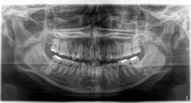 istock X-ray film Head and mouth 1080521636