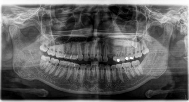 istock X-ray film Head and mouth 1080522092