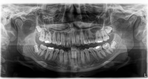 istock X-ray film Head and mouth 1080522218