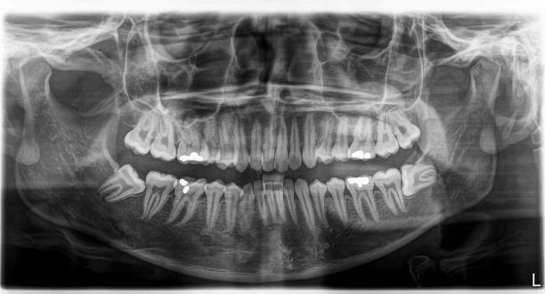 istock X-ray film Head and mouth 1080522278