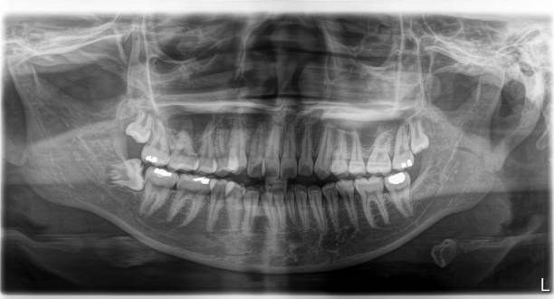 istock X-ray film Head and mouth 1080522286