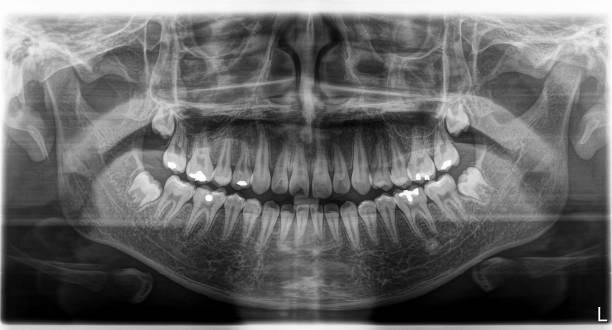 istock X-ray film Head and mouth 1080522878