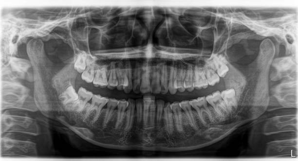 istock X-ray film Head and mouth 1080525280