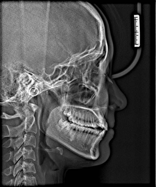 istock X-ray film Head and mouth 1080533252