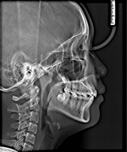 istock X-ray film Head and mouth 1080533586