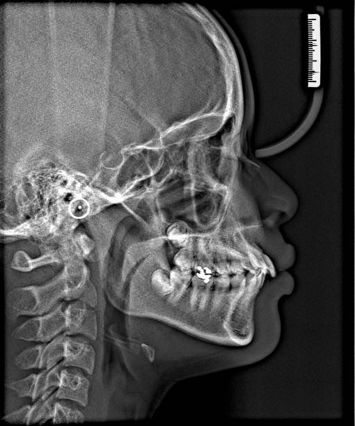 istock X-ray film Head and mouth 1080533664