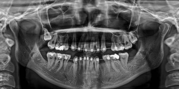 istock X-ray film Head and mouth 1080534016