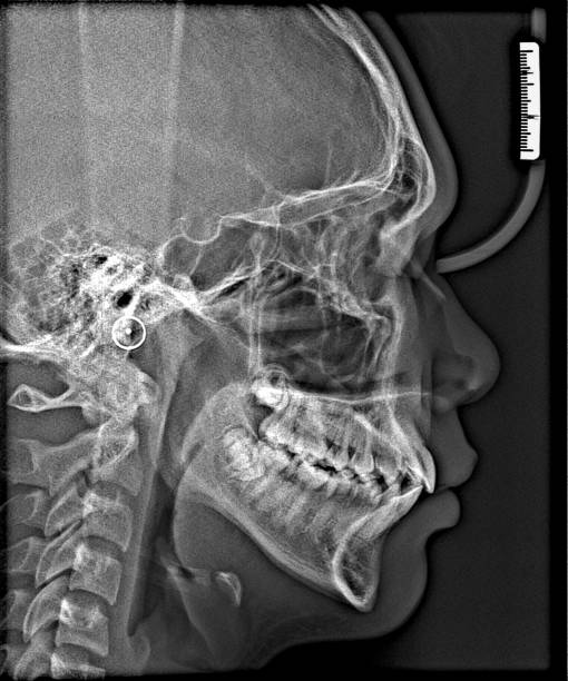 istock X-ray film Head and mouth 1080536324