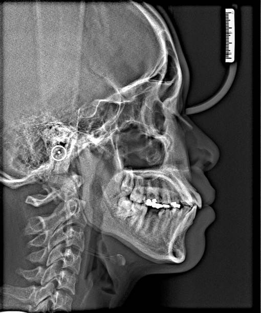 istock X-ray film Head and mouth 1080536480