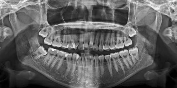 istock X-ray film Head and mouth 1080537082