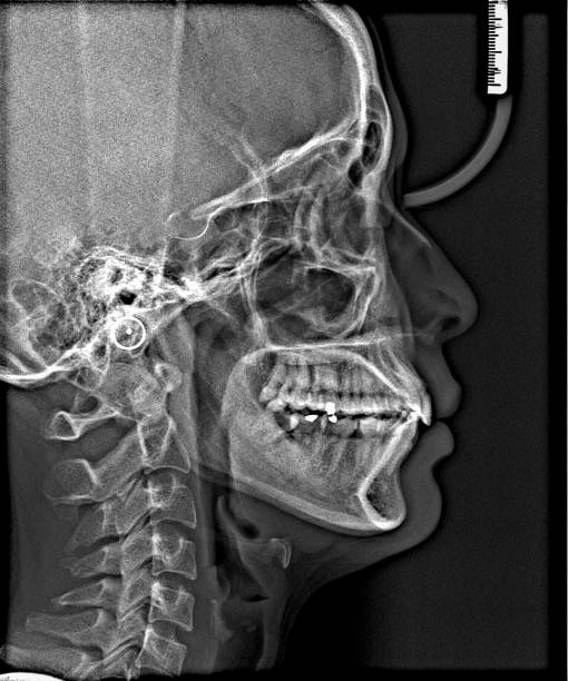 istock X-ray film Head and mouth 1080539158