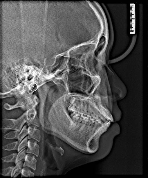 istock X-ray film Head and mouth 1080541046