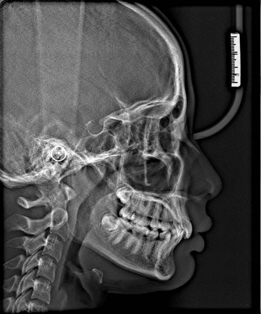 istock X-ray film Head and mouth 1080545480